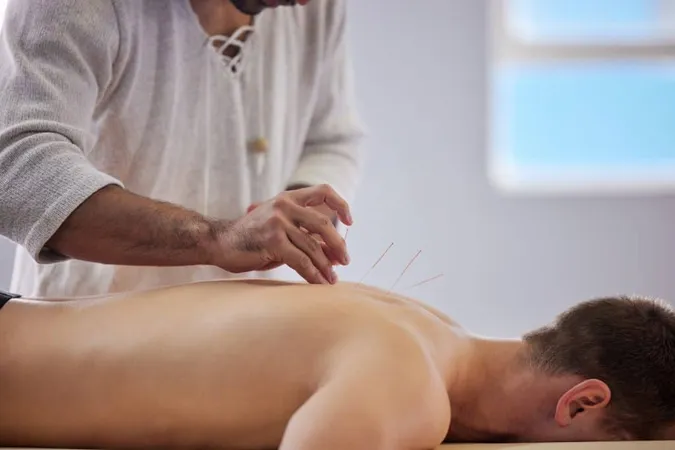 Ive Never Felt More Relaxed Shot Acupuncturist Treating Client X - Acupuncture Physician study guide